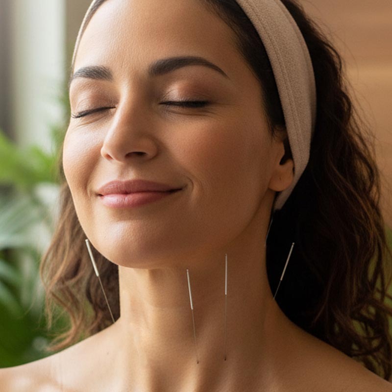 dry needling treatments with chiropractor marrickville