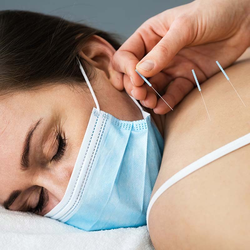 dry needling treatments with chiropractor marrickville